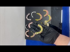 جسر Ti-Bar Zirconia الهجين