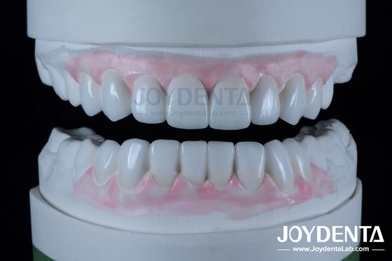 شراء استعادة الأسنان بدقة عالية الشمع في طب الأسنان سمك 1-2 ملم التصنيع عبر الإنترنت