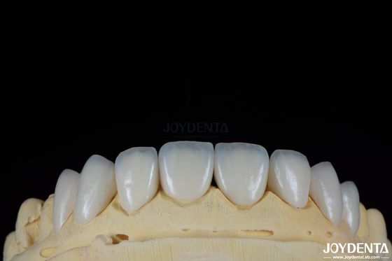 شراء أظافر الأسنان المقاومة للبقع والدائمة مع ظلال شخصية للأسنان الطبيعية التصنيع عبر الإنترنت