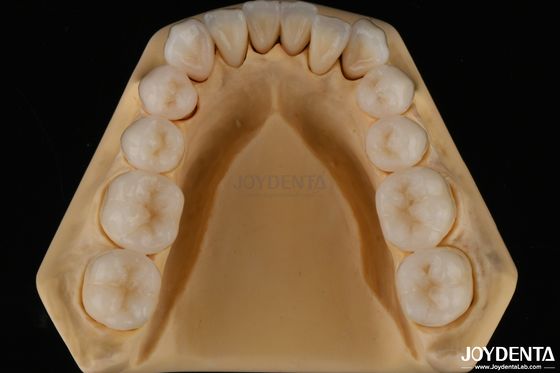 شراء 3D متعدد الطبقات الأسنان الزركونيا الكاملة مقاومة الشظايا بنية الأسنان الطبيعية التصنيع عبر الإنترنت