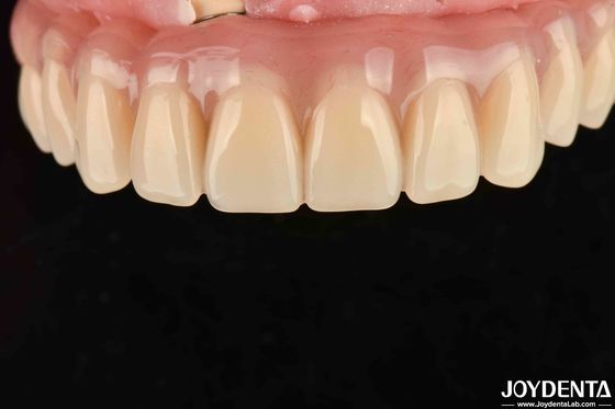 شراء تجفيف سريع 5 دقائق أكريليك الأسنان النهاية لاستعادة الأسنان التصنيع عبر الإنترنت