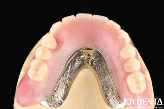 شراء ربط الأسنان بثبات إعداد إطار تكنولوجي لإنهاء الأسنان لمتخصصي طب الأسنان والنتائج الدقيقة التصنيع عبر الإنترنت