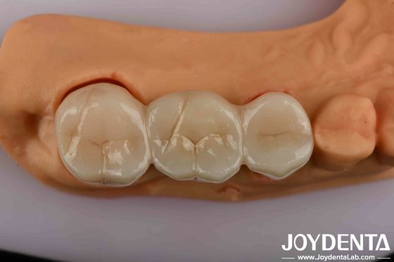 شراء زيركونيا الأسنان ذات القوة العالية الحل النهائي لجماليات طبيعية التصنيع عبر الإنترنت