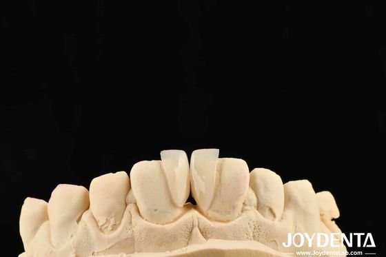 شراء صلبة عالية ميكرو فنير سمك 0.2 ملم وأداء موثوق به التصنيع عبر الإنترنت