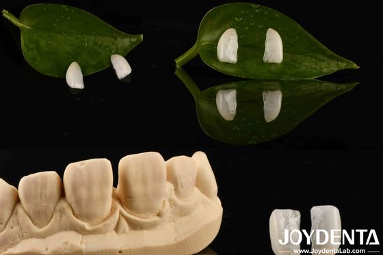 شراء متانة عالية القشرة الميكرو رقيقة للغاية مع الخشب الطبيعي 0.2mm سمك التصنيع عبر الإنترنت