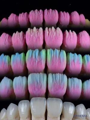 شراء The Joydenta Ceramic Veneer Process التصنيع عبر الإنترنت