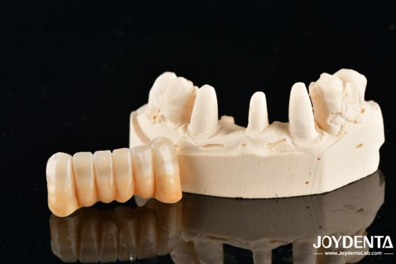 شراء Unveil True Biomimicry: Introducing Our Multi-Layered Zirconia Aesthetic Bridge التصنيع عبر الإنترنت