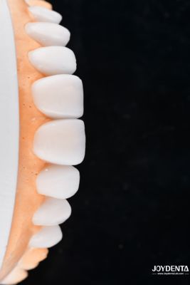 شراء Enhance Case Acceptance & Patient Communication with Our Diagnostic Wax-Up Service التصنيع عبر الإنترنت