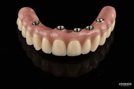 شراء Redefining Full Arch Prosthetics: Unmatched Fit and Function with Our Ti-Base Complete Dentures التصنيع عبر الإنترنت