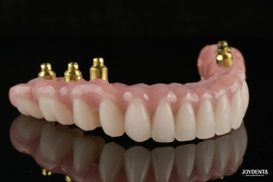 شراء The Strength of Titanium, The Art of Natural Aesthetics. التصنيع عبر الإنترنت