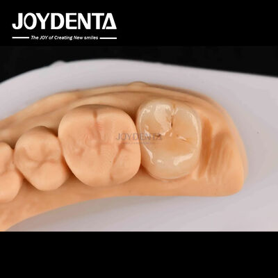 شراء قوة عالية Emax Inlay Onlay A2 لون طويل الأمد لاستعادة الأسنان المتضررة التصنيع عبر الإنترنت