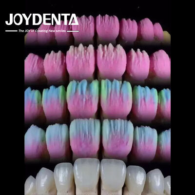 شراء The Joydenta Ceramic Veneer Process التصنيع عبر الإنترنت