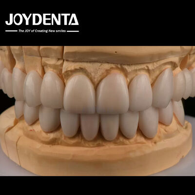 شراء 0.3 ملم سمك Ips Emax Veneers Veneers السيراميكية التصنيع عبر الإنترنت