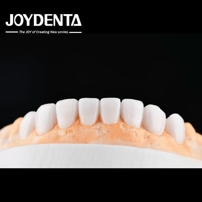 شراء Enhance Case Acceptance & Patient Communication with Our Diagnostic Wax-Up Service التصنيع عبر الإنترنت