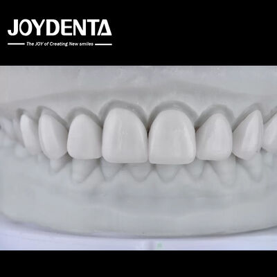 شراء Visualize the Result, Secure the Case: Our Diagnostic Wax-Up Service التصنيع عبر الإنترنت