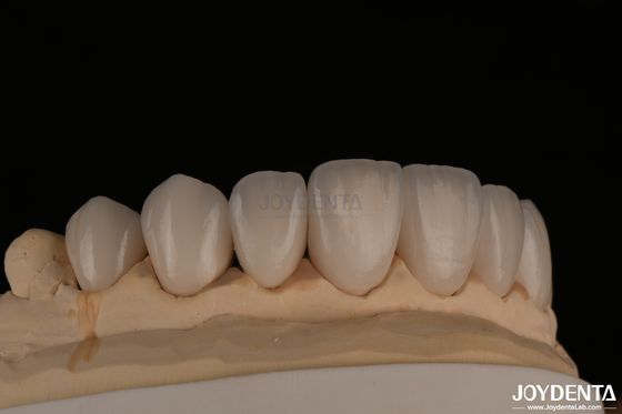 فيلدسباتيك طبيعي المظهر المزخرفة المزخرفة مناسبة بدقة شفافة للغاية