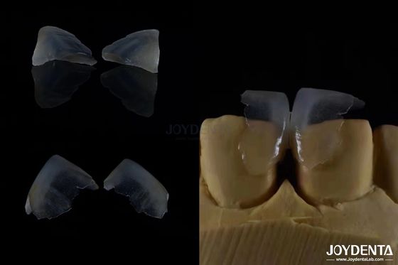 الحد الأدنى من الغزوات التجميلية الأسنان القشرة الزجاجية السيراميكية لون رقيق للغاية