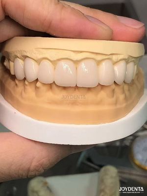 16 ظلال لون إماكس الأسنان الفينيرات A1-A4 مقاومة عالية للبقع لابتسامة مثالية