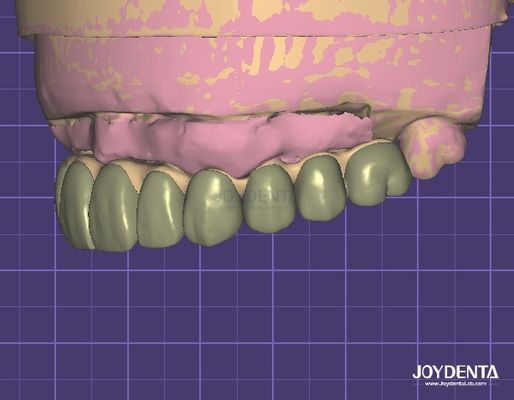 أمن البيانات المتوافق مع HIPAA نموذج رقمي 3D للقيام بتعديلات الأسنان