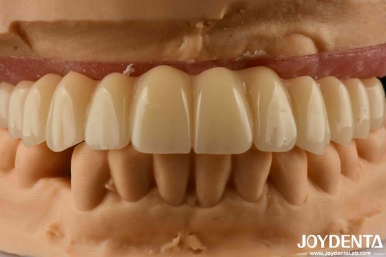 محلول الأسنان القاعدة الـ Ti Zirconia الجسر الهجاني التوافق الحيوي العالي المظهر الطبيعي