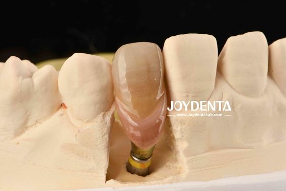 0° الزاوية الأسنان المنتهية الأسنان 1.5mm الخيط المزاج سطح مطلي