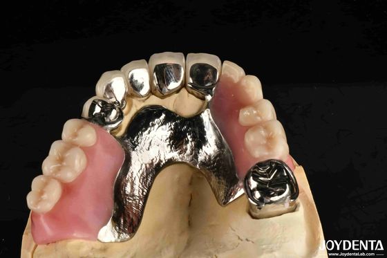 إعداد إطار نهائي هيكل الأسنان المستقر تصميم الأسنان النهاية