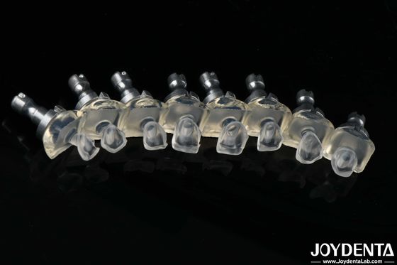 الزجاج الشفاف للغاية البورسلين الأسنان القشرة القوة العالية 0.3-0.8mm سمك
