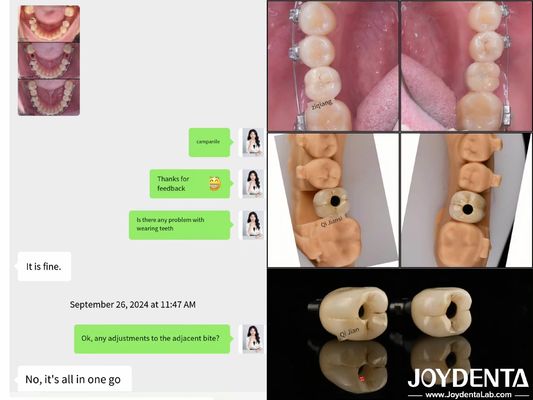 زراعة الأسنان ذات القوس الكامل طويل الأمد زراعة الأسنان الداخلية الطول 10mm-16mm