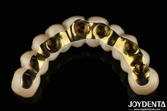 مصنوعة خصيصاً من الـ Ti-Bar Zirconia الجسر الهجاني الدقيق