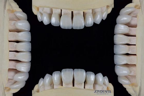 القشرة الفيلدسباتيكية الرقيقة للغاية 0.3-0.5mm سمك مقاومة عالية للبقع مناسبة بدقة