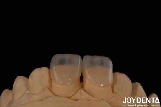 الصديقة للبيئة ميكرو أسنان الأسنان القشرة 0.2mm سمك نسيج ناعم