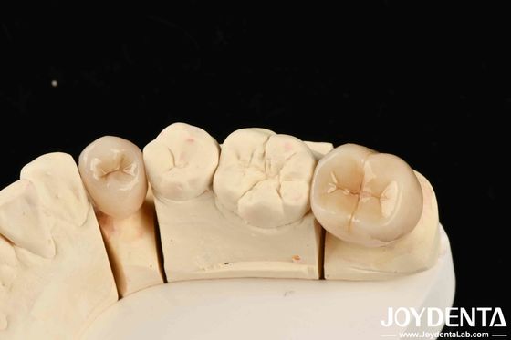 التوافق البيولوجي الممتاز الزركونية الكاملة مع مقاومة عالية للتآكل وقوة الانحناء من 1000 MPa