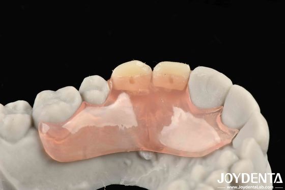 إطار تصميم مظهر جميل ومتناغم وضع الأسنان النهاية تقنية معقدة لهيكل الفم المستقر