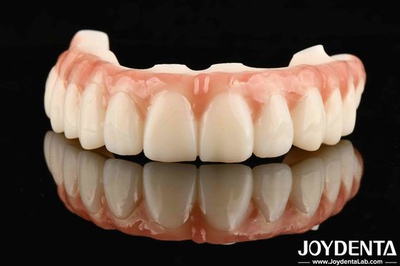 سطح مقاوم للخدش لإعادة التجميل الطويل الأمد M75 إعادة التجميل الدائم