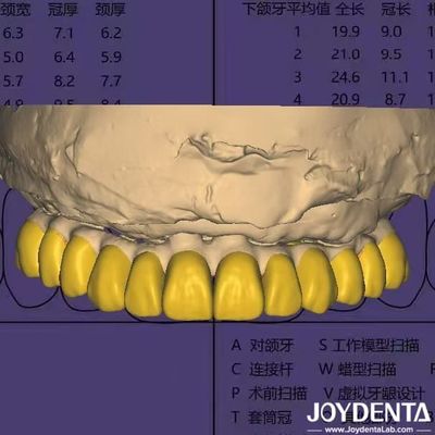 الاسم